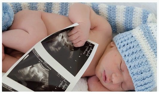 Newborn Photo - Baby with Ultrasound