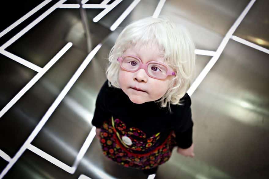 A Girl With Albinism, Valencia, Spain Photo Contest